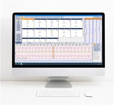 Dinamiskā EKG holtera analīzes sistēma